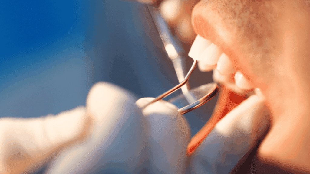 Mercury Amalgam removal