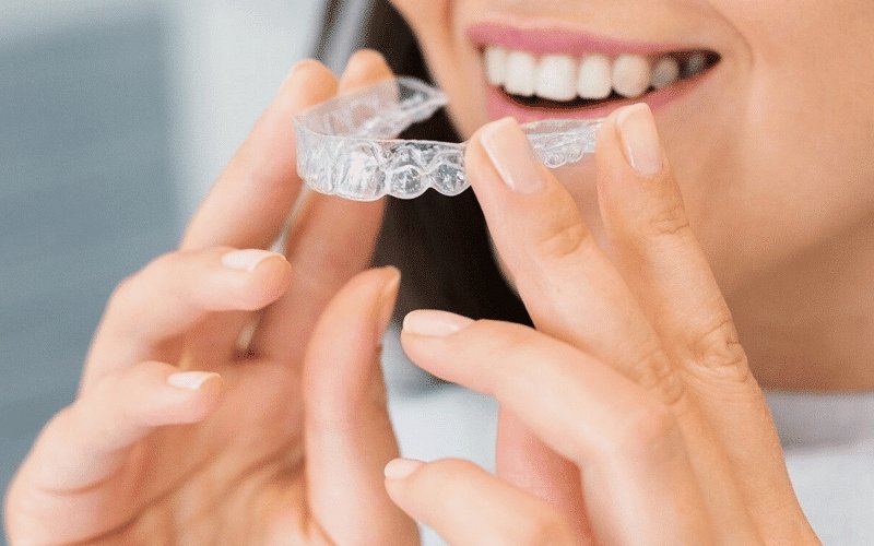 invisalign treatment image