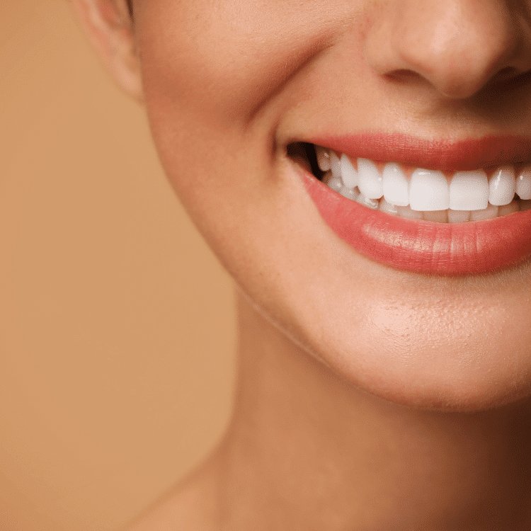 Porcelain Veneers