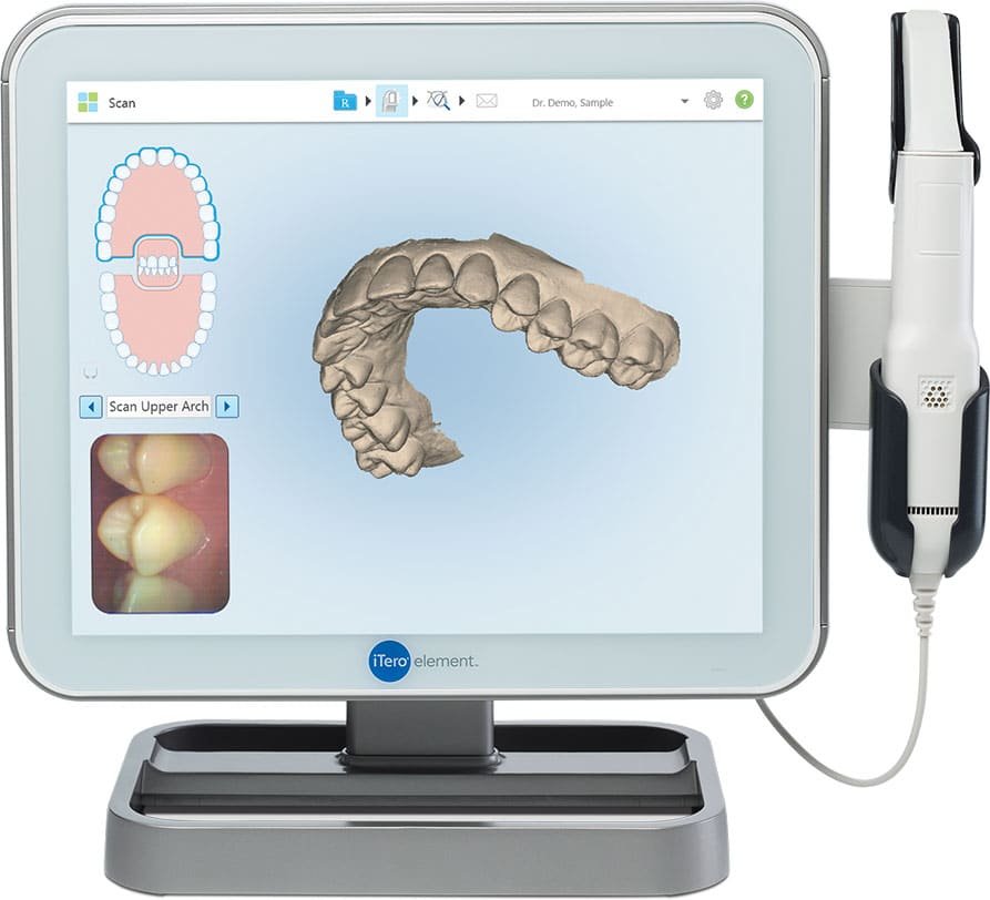 itero-scanner